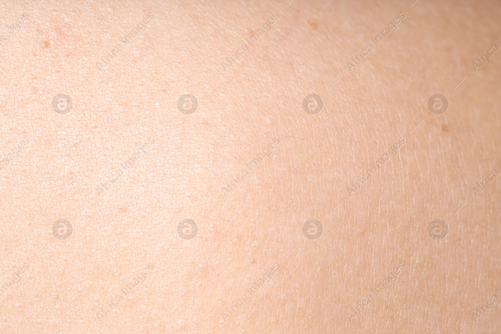 Texture of normal skin as background, closeup Photo of Texture of normal skin as background, closeup