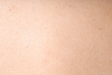 Photo of Texture of normal skin as background, closeup