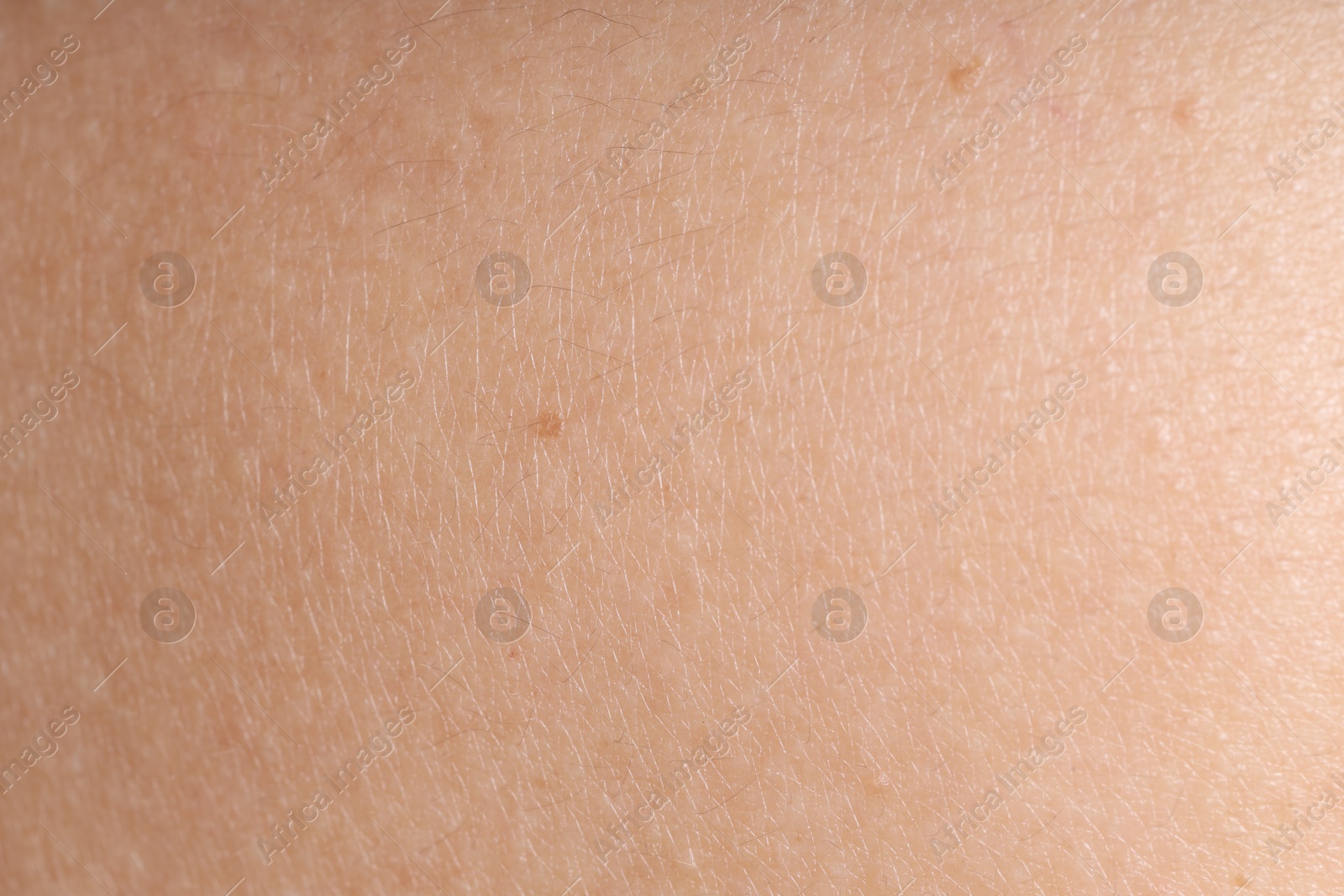 Texture of normal skin as background, closeup Photo of Texture of normal skin as background, closeup