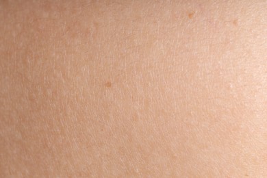 Photo of Texture of normal skin as background, closeup