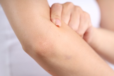 Photo of Closeup view of woman with normal skin