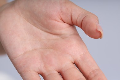 Photo of Woman with normal skin on light background, closeup