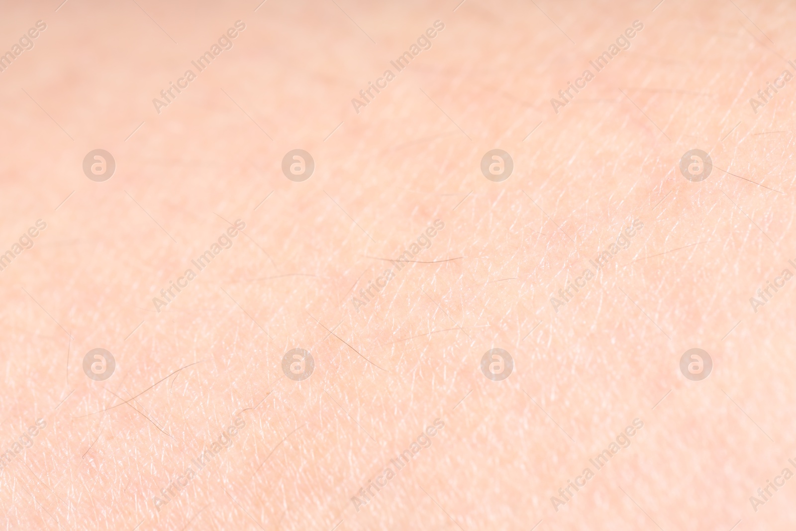 Photo of Texture of normal skin as background, closeup