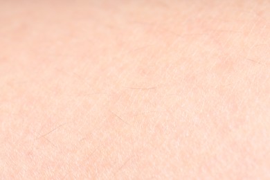 Photo of Texture of normal skin as background, closeup