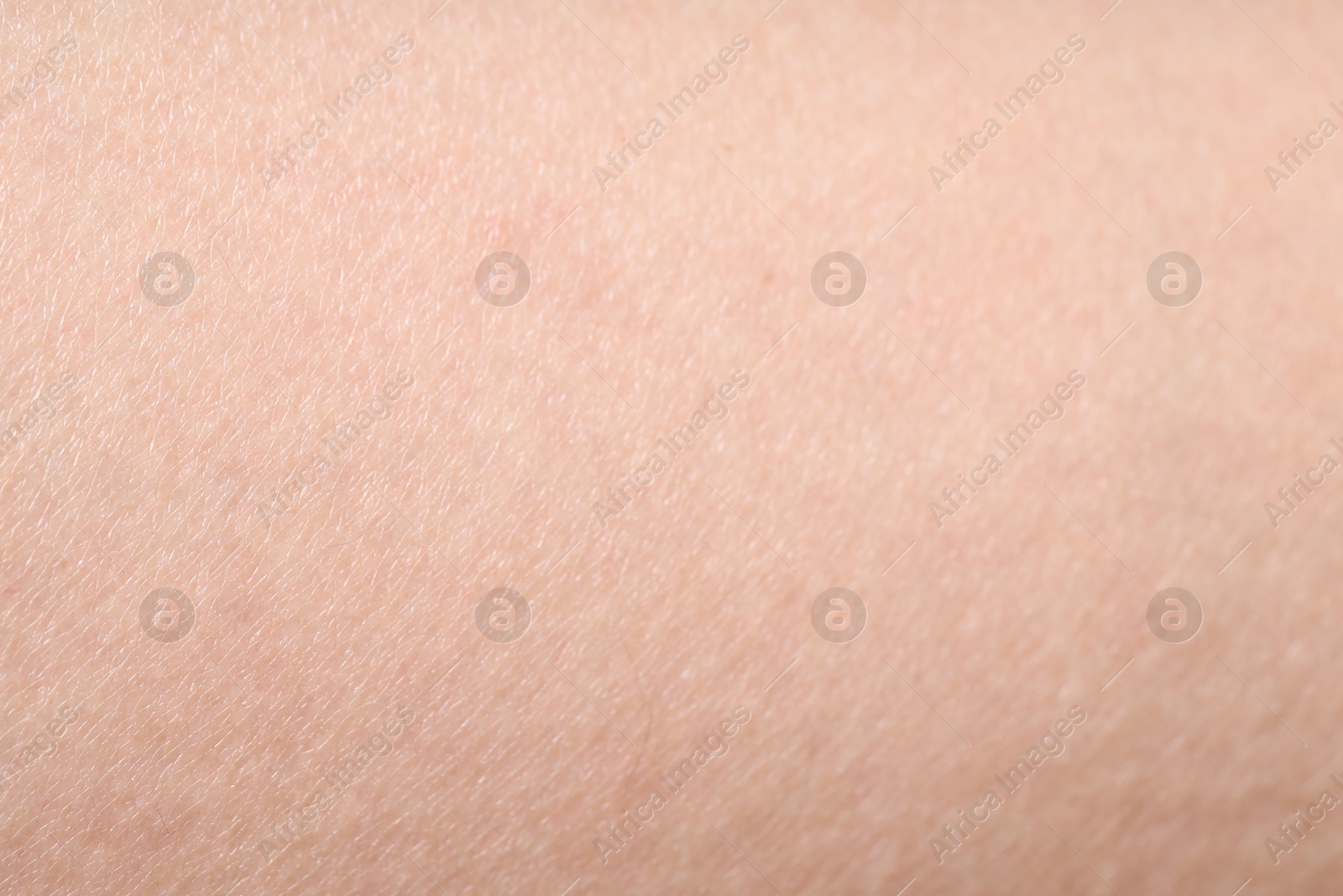 Photo of Texture of normal skin as background, closeup