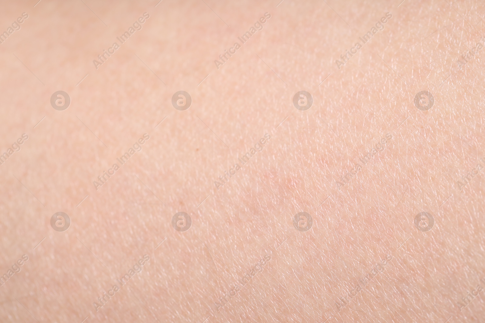 Photo of Texture of normal skin as background, closeup
