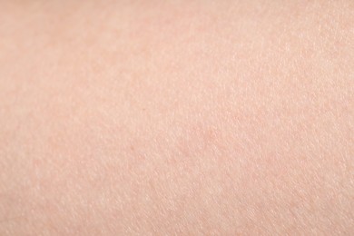 Photo of Texture of normal skin as background, closeup