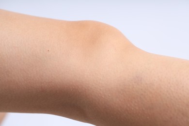 Photo of Woman with normal skin on light background, closeup