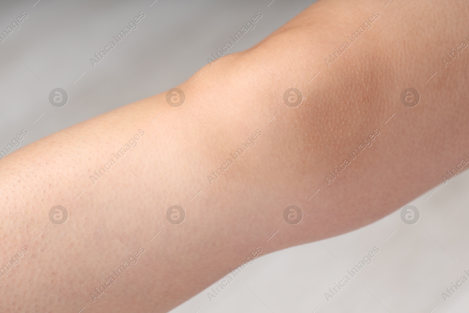 Photo of Woman with normal skin on blurred background, closeup
