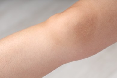 Photo of Woman with normal skin on blurred background, closeup