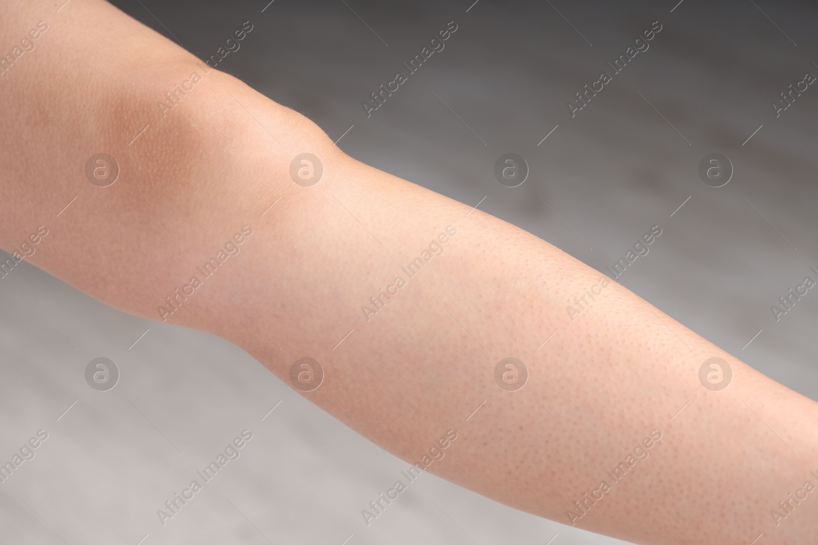 Photo of Woman with normal skin on blurred background, closeup