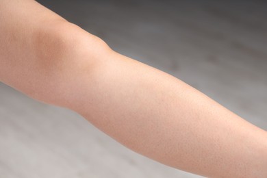 Photo of Woman with normal skin on blurred background, closeup