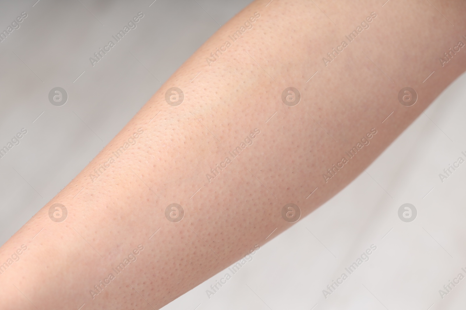 Photo of Woman with normal skin on blurred background, closeup