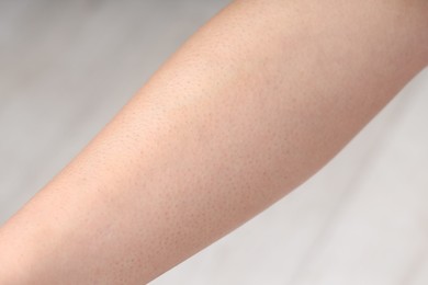Photo of Woman with normal skin on blurred background, closeup