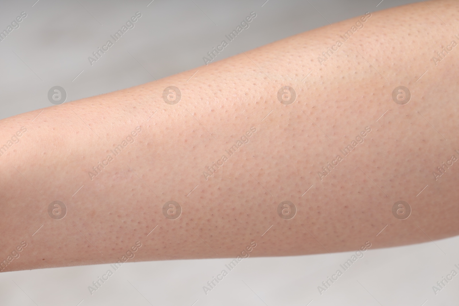 Photo of Woman with normal skin on blurred background, closeup