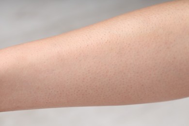 Photo of Woman with normal skin on blurred background, closeup