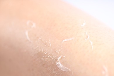 Photo of Closeup view of woman with dry skin