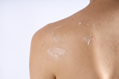 Photo of Woman with dry skin on her body against light background, closeup
