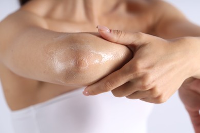 Photo of Woman with dry skin on her elbow against light background, closeup