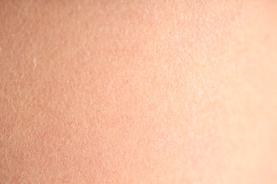 Photo of Texture of normal skin as background, closeup