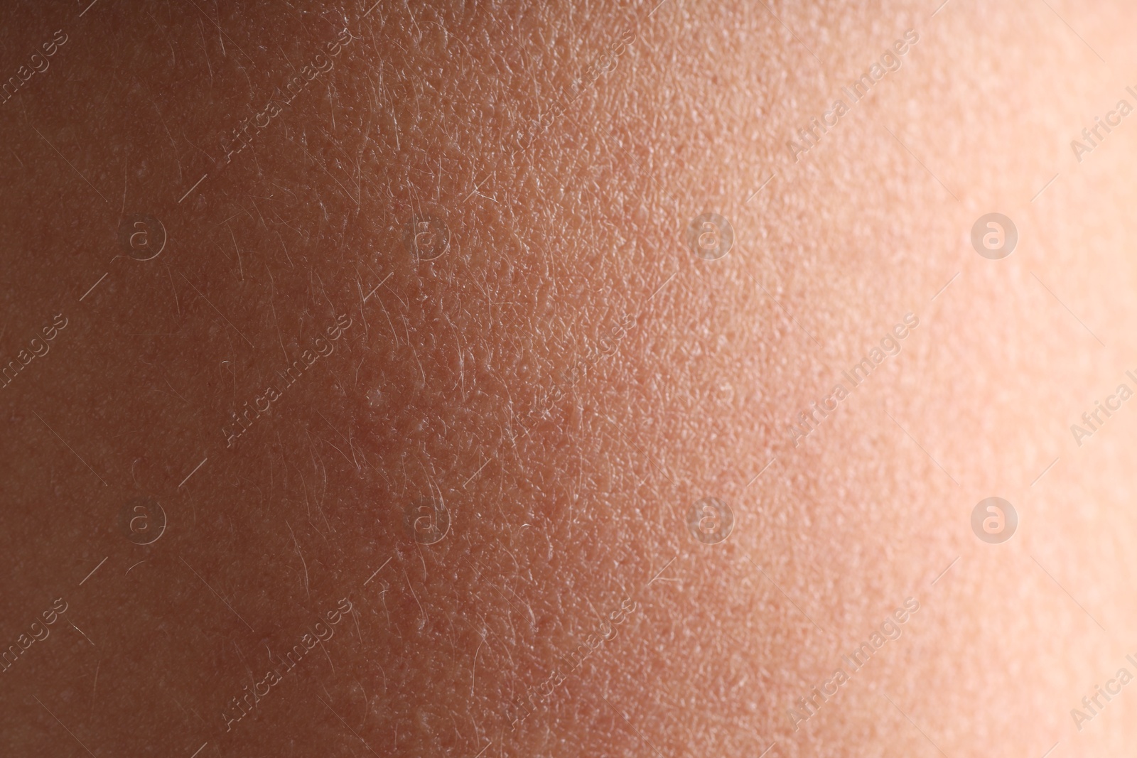 Photo of Texture of normal skin as background, closeup