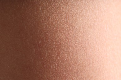 Photo of Texture of normal skin as background, closeup