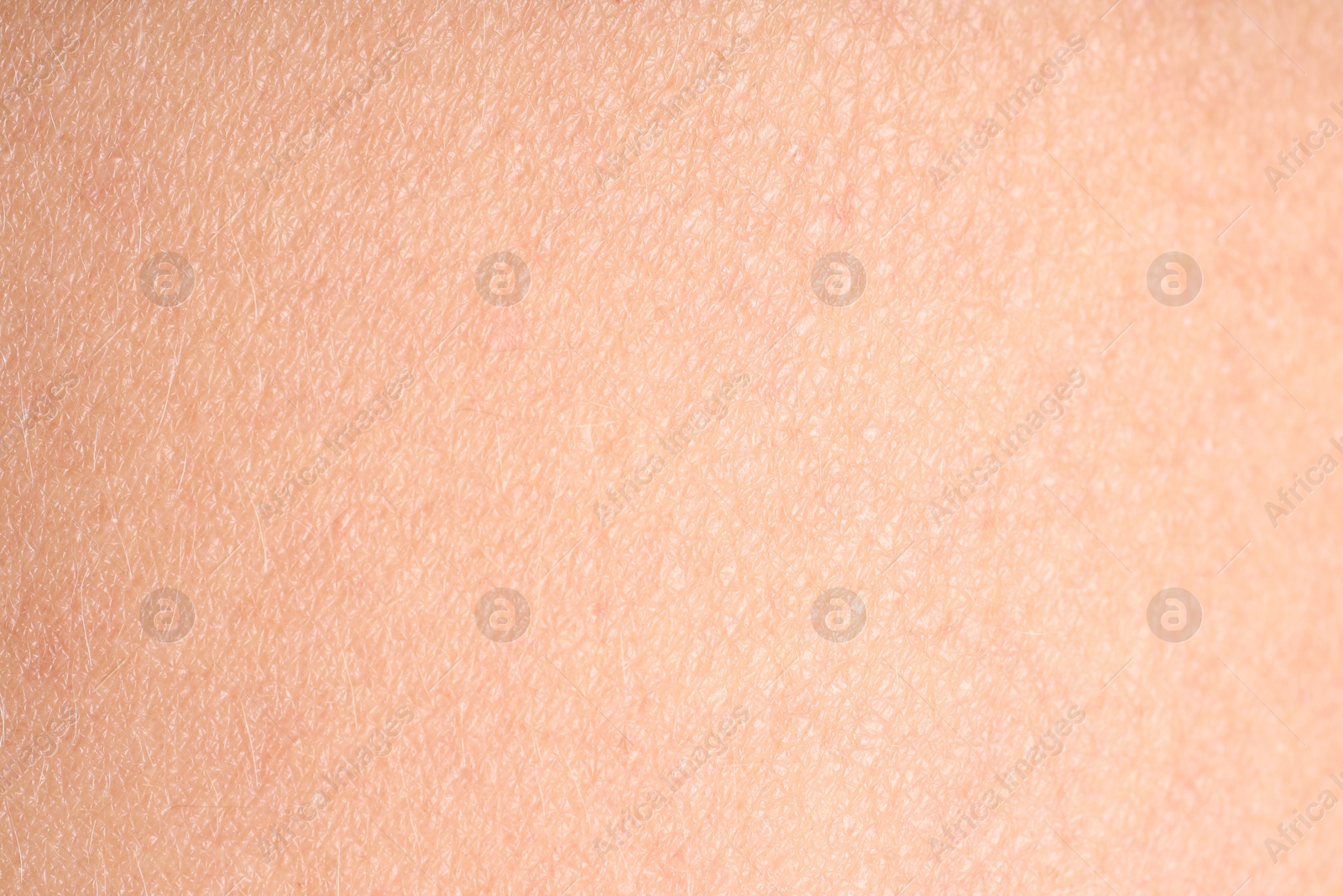Photo of Texture of normal skin as background, closeup