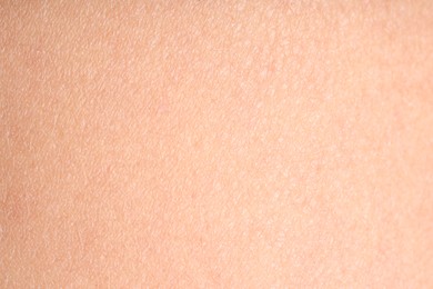 Photo of Texture of normal skin as background, closeup