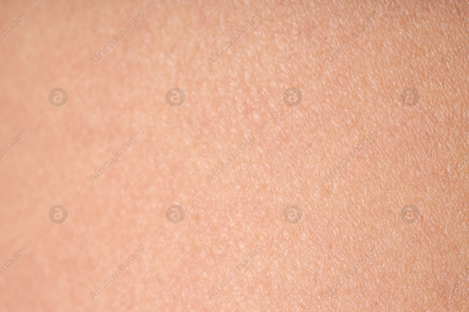 Photo of Texture of normal skin as background, closeup