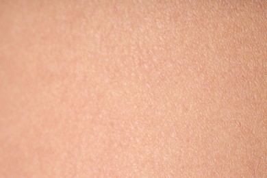 Photo of Texture of normal skin as background, closeup