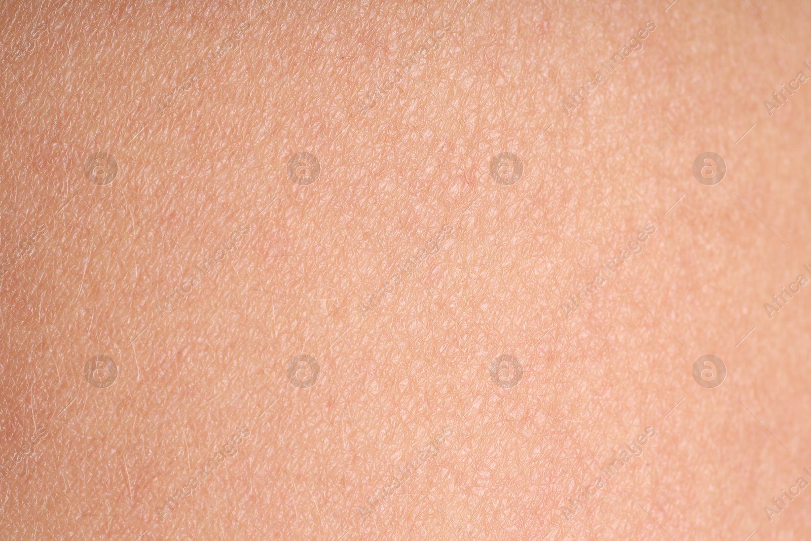 Photo of Texture of normal skin as background, closeup