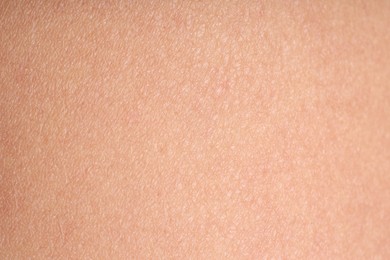 Photo of Texture of normal skin as background, closeup