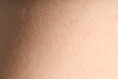 Photo of Texture of normal skin as background, closeup