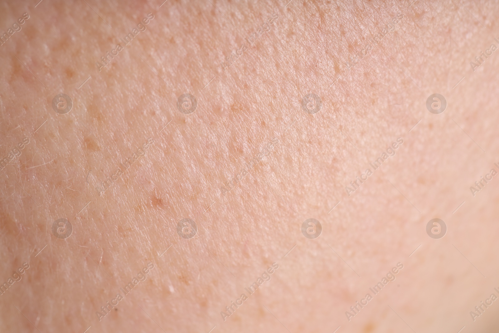 Photo of Texture of normal skin as background, closeup