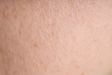 Photo of Texture of normal skin as background, closeup