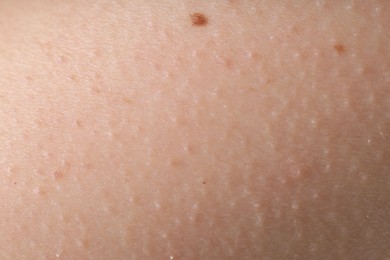 Photo of Texture of normal skin as background, closeup
