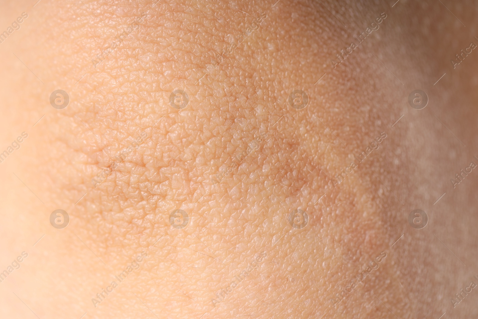 Photo of Texture of normal skin as background, closeup