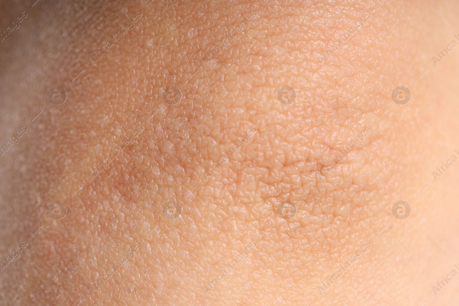 Photo of Texture of normal skin as background, closeup