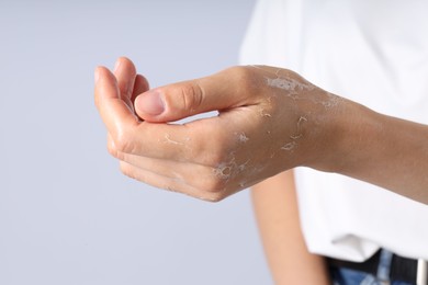 Photo of Woman with dry skin on her hand against light background, closeup