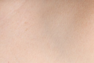 Photo of Texture of normal skin as background, closeup