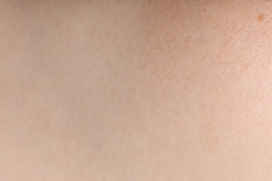 Photo of Texture of normal skin as background, closeup
