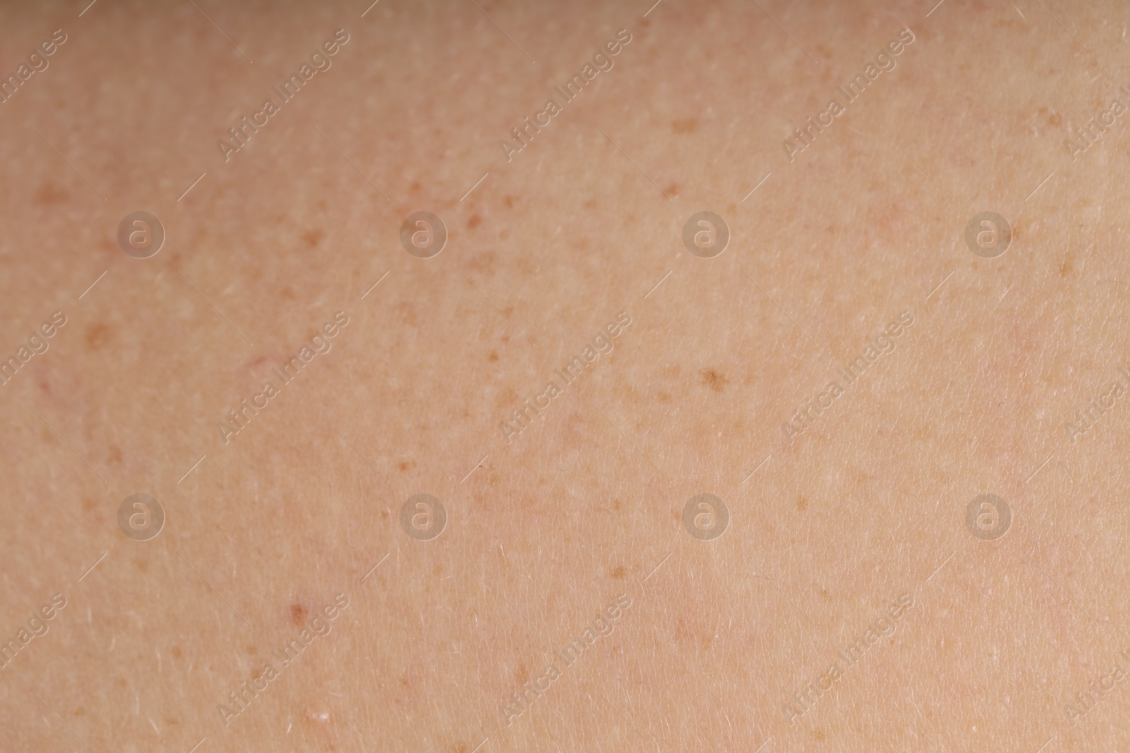 Photo of Texture of normal skin as background, closeup