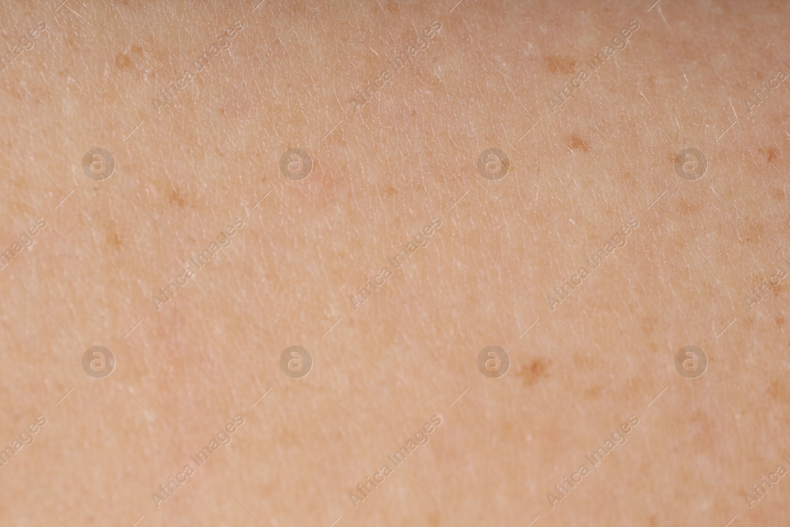 Photo of Texture of normal skin as background, closeup