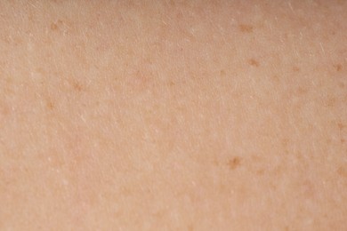 Photo of Texture of normal skin as background, closeup