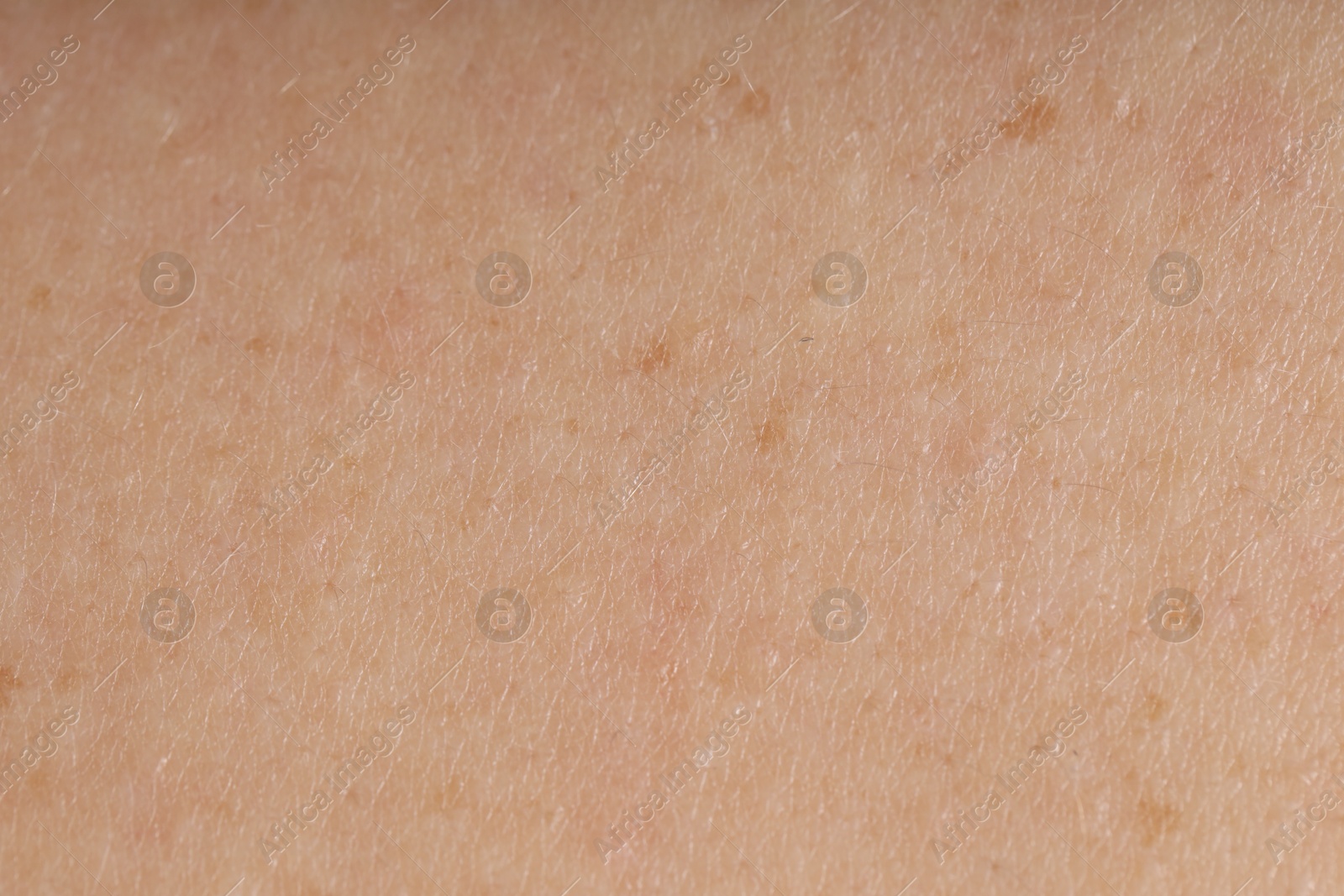 Photo of Texture of normal skin as background, closeup