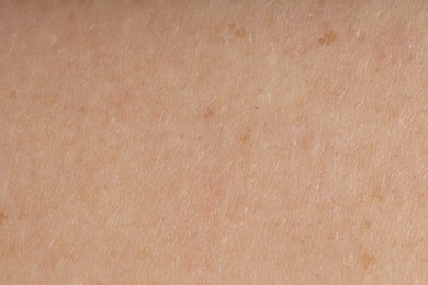 Photo of Texture of normal skin as background, closeup