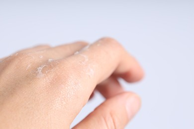 Photo of Woman with dry skin on her hand against light background, closeup. Space for text