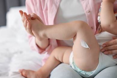 Photo of Mother and baby with cream on his leg at home, closeup