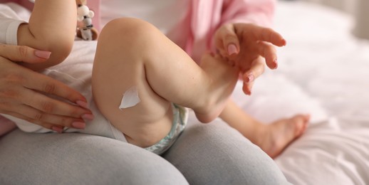 Photo of Mother and baby with cream on his leg at home, closeup