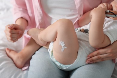Photo of Mother and baby with cream on his leg at home, closeup
